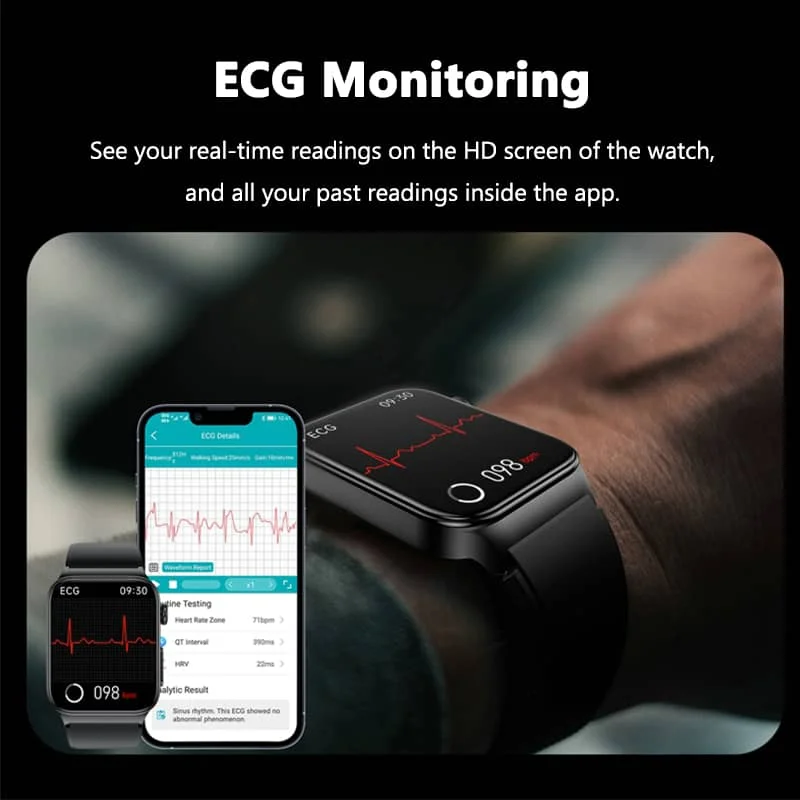 Cauzac™ Advanced Health Monitoring Smartwatch with ECG and Fitness Tracking